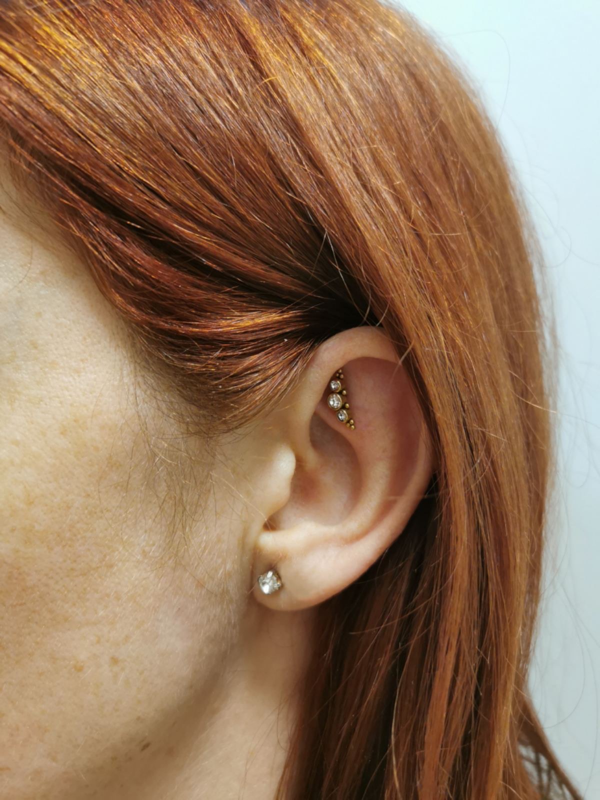 Közérzetjavító piercing — Daith és Shenmen